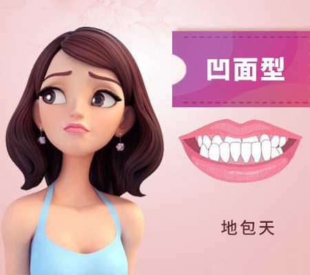 什么是地包天？地包天長什么樣子？地包天牙齒圖片