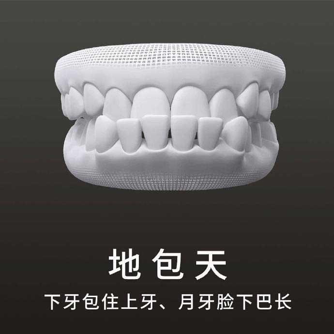 什么是地包天？地包天長什么樣子？地包天牙齒圖片